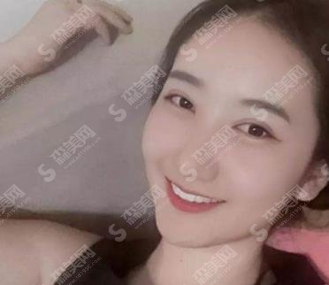 天津医科大学口腔医院牙齿矫正怎么样?矫正进程如何?需要矫正的时间长吗?价格公布