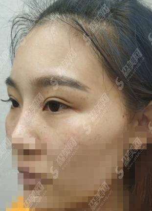 兴义市人民医院医学美容科是行业内好的的存在，案例见证医院实力