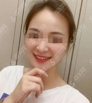 上海英博口腔门诊部专业不？一览医院口腔治疗果和较新版本手术价格