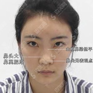 北京碧薇医疗美容医院口碑如何?实力/建设/医生全部进行介绍,有真人案例让你更直观的感受他的实力!