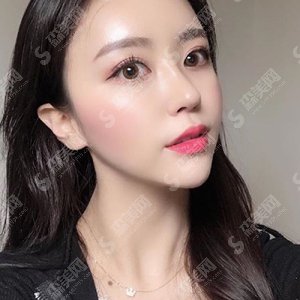 北京碧薇医疗美容医院口碑如何?实力/建设/医生全部进行介绍,有真人案例让你更直观的感受他的实力!