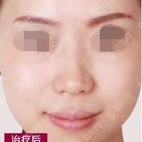 益阳市中心医院整形美容科祛疤果好不好？详细案例一看便知，脸上或者身上有疤的妹子们要注意仔细看了