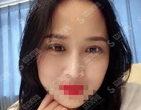 邯郸整形医院前列是哪家？维多利亚简介来了/医生介绍/案例都有！