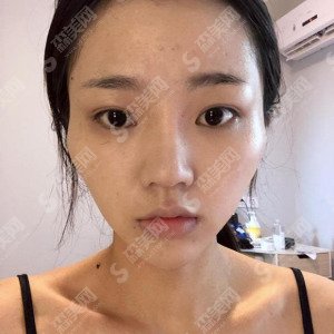 成都艾米丽医院靠谱吗?医院的实力/特色/医生都是怎么样的那?美肤嫩肤的果给你解答!