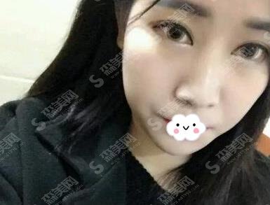 成都较好的整形医院前列相关介绍,铜雀台医院简介/医生信息/案例果全在此了!