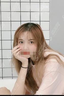 热玛吉在哪里做比较好?上海华美做的热玛吉如何？坐诊的医生技术怎么样？热玛吉恢复过程！