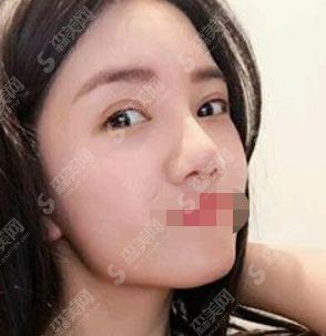 做开眼角塑型术谁更有底气？来上海长征医院，他会给你满意的答复，让你的眼睛瞬间变大一倍不止