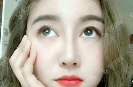 李保锴医生资料信息大曝光!隆鼻案例这里通通都有!快来看看果好不好?