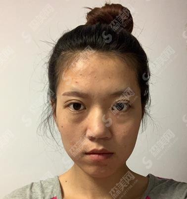 穆宝安医生简介，医生技术实力如何呢？相关案例分享看看便知！