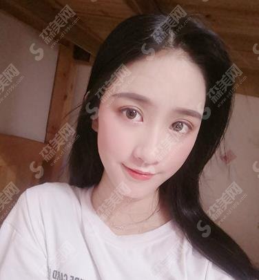 北京深圳医院胡华新所做双眼皮手术如何?医生信息公布/价格表/案例果