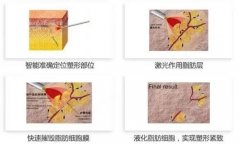 激光溶脂和射频溶脂哪个好？技术原理/优势特点/适用的问题全部进行了讲解,附带了溶脂的果来进行诠释！