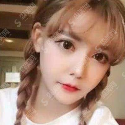 韩安冉整容？整容后好看吗？整容前后的变化真的是全网都在见证，一现在的她是什么样子呢？！