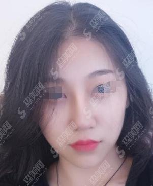 北京隆鼻专家一一介绍！附隆鼻案例+隆鼻价格一览，技术完全不用担忧！赶快围观！
