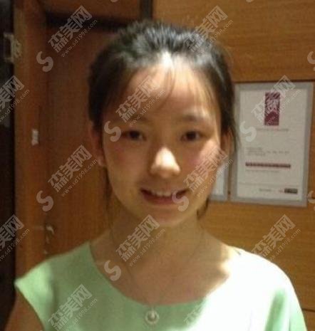 陈卓璇整容？到底是不是真的？和她出道前的和照片对比呢？脸部有明X变化，有很大的差别吗？
