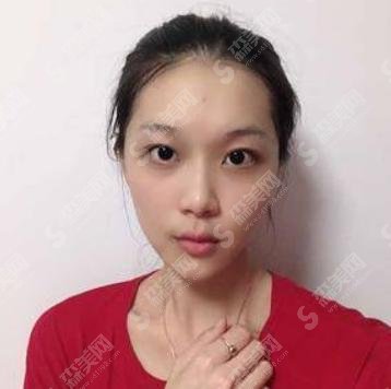 陈柏森医生是做什么手术的?对面部的研究很深吗?做出来的果怎么样?技术怎么样?一起来了解一下。