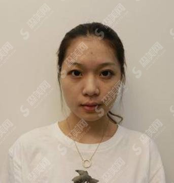 陈柏森医生是做什么手术的?对面部的研究很深吗?做出来的果怎么样?技术怎么样?一起来了解一下。