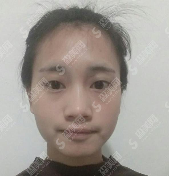 张侠医生是做什么项目的?所在医院靠谱嘛?案例果真实自然吗?一起来看看该良心医生吧!