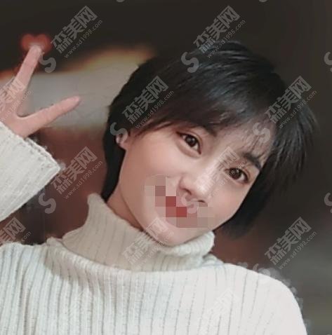 张侠医生是做什么项目的?所在医院靠谱嘛?案例果真实自然吗?一起来看看该良心医生吧!