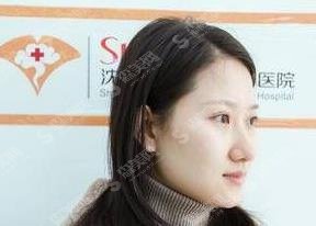 穆雄铮磨骨案例,附2021价格表参考!医生相关信息了解