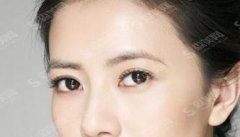 济南双眼皮整形医生排名榜前五强,实力口碑好的医院名单介绍,看看都有哪家呢!