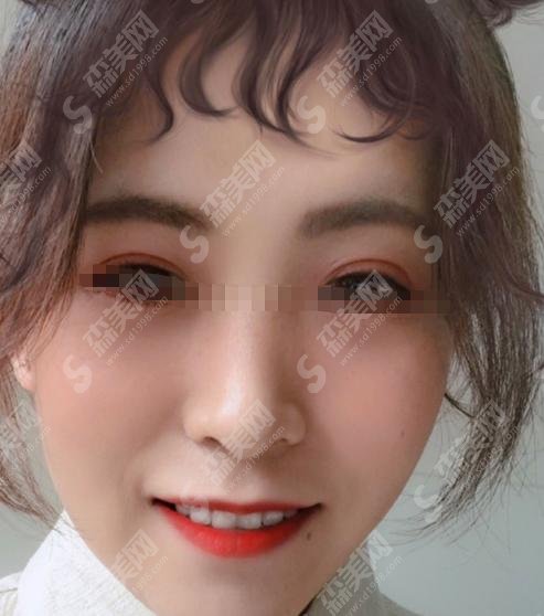 德阳市第三人民医院口腔科值得去吗？李莎、宋一平等医生口碑如何？附牙齿种植术后恢复过程和较新种植价格！