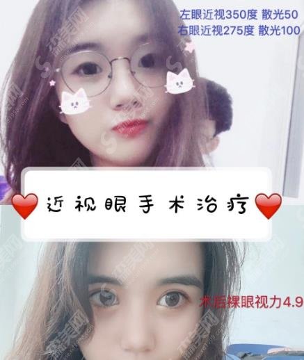 郑州近视眼手术医院排名榜公布，第九人民医院/博爱/郑东院区实力都强，附近视眼手术案例