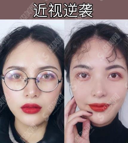 郑州做近视手术较好的医院有哪些?简介|医生推荐|近视案例都有&价格表