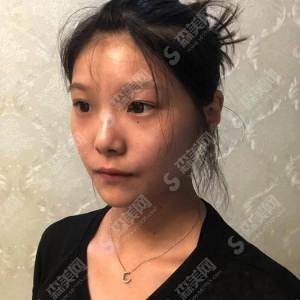 丽珠兰和抗衰产品哪个好?品牌原理/优势特点/区别详解&注射水光补水的果分享!