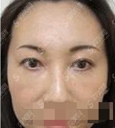 南昌大学第一附属(南昌一附)医院整形科,医院的水平还是很高的,医生也很厉害!