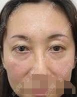 南昌大学第一附属(南昌一附)医院整形科,医院的水平还是很高的,医生也很厉害!