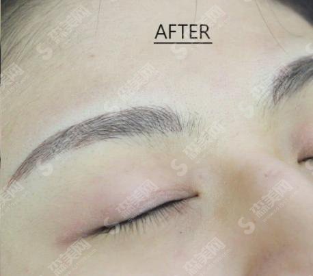 青岛市立医院美容科纹眉做的怎么样?自然的别人根本看不出来呢