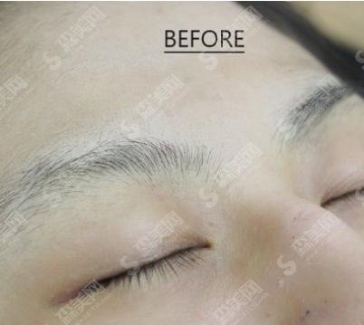 青岛市立医院美容科纹眉做的怎么样?自然的别人根本看不出来呢