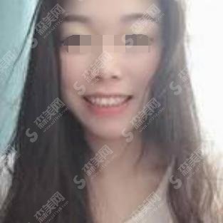 贵阳市口腔医院价格表查询,附牙齿矫正案例