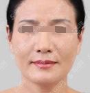 成都二医院整形科做热玛吉口碑,靠谱的整形医院推荐!