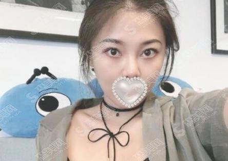 2021上海华美热玛吉多少钱？价格分享给每一位追美的你们！