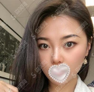 2021上海华美热玛吉多少钱？价格分享给每一位追美的你们！