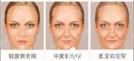 2021有谁做过热玛吉?热玛吉如此风靡的原因在这里