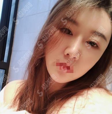 2021有谁做过热玛吉?热玛吉如此风靡的原因在这里