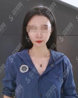 热玛吉新一代做一次需要多少钱？手术的没问题指数有多少？