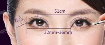 2021双眼皮价格表，项目介绍+优点分享+案例展示