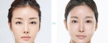 上海lj医美水平怎么样?医生案例+医院介绍分享给大家!