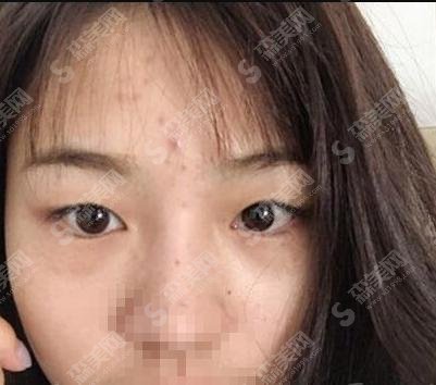 上海lj医美水平怎么样?医生案例+医院介绍分享给大家!