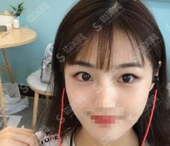 上海lj医美水平怎么样?医生案例+医院介绍分享给大家!