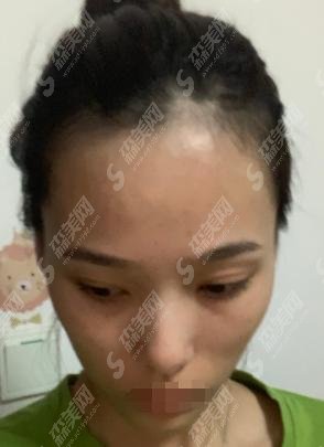 动能素的功作用是什么?服用多久的动能素的优点是什么?