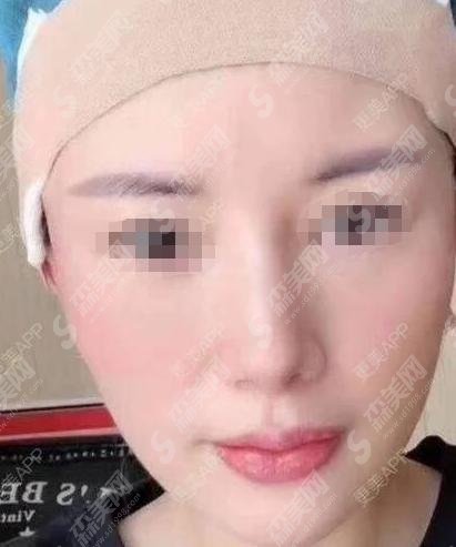 2021热玛吉第五代多少钱?做热玛吉的医院推荐给大家!