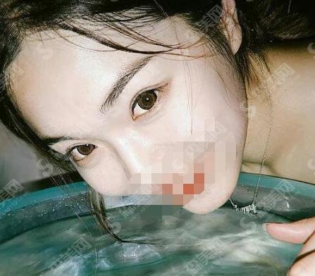 银川西京整形医院胡守舵怎么样?医生简介+医院简介+双眼皮案例