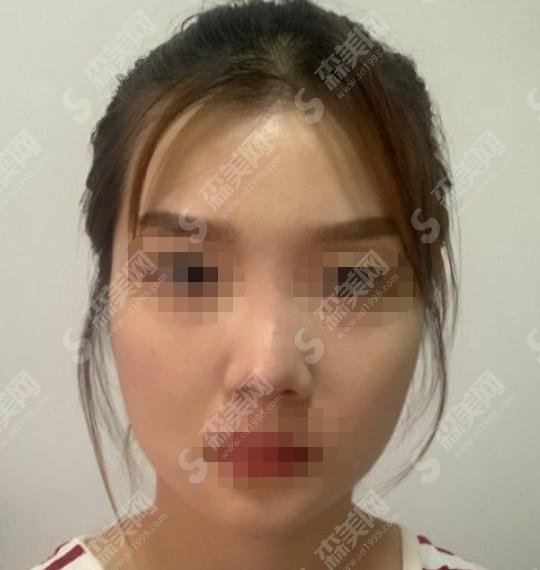 南京维多利亚金颂良怎么样？医生简介+成功案例分享
