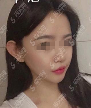 金一秀在上海哪几家医院坐诊？上海韩镜整形_医生的手术案例做的一绝！