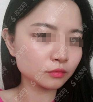 金一秀在上海哪几家医院坐诊？上海韩镜整形_医生的手术案例做的一绝！