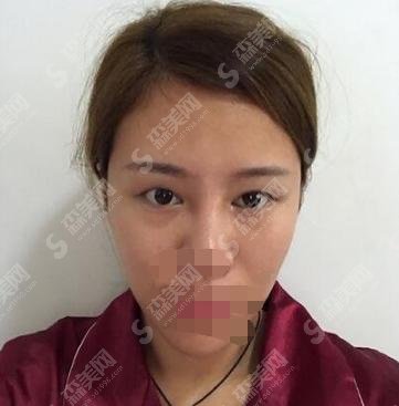 2021北京八大处靳小雷怎么预约?医院水平和医生实力果然厉害!